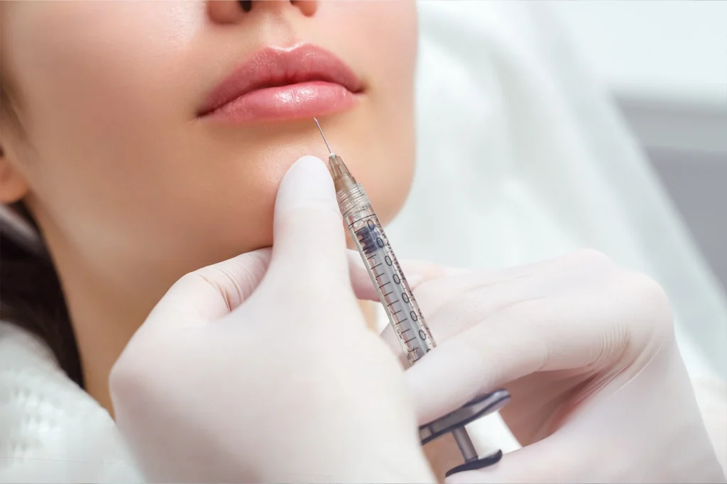 Clinician guides a fine syringe toward the lower lip during an injectable filler procedure for facial volume enhancement.